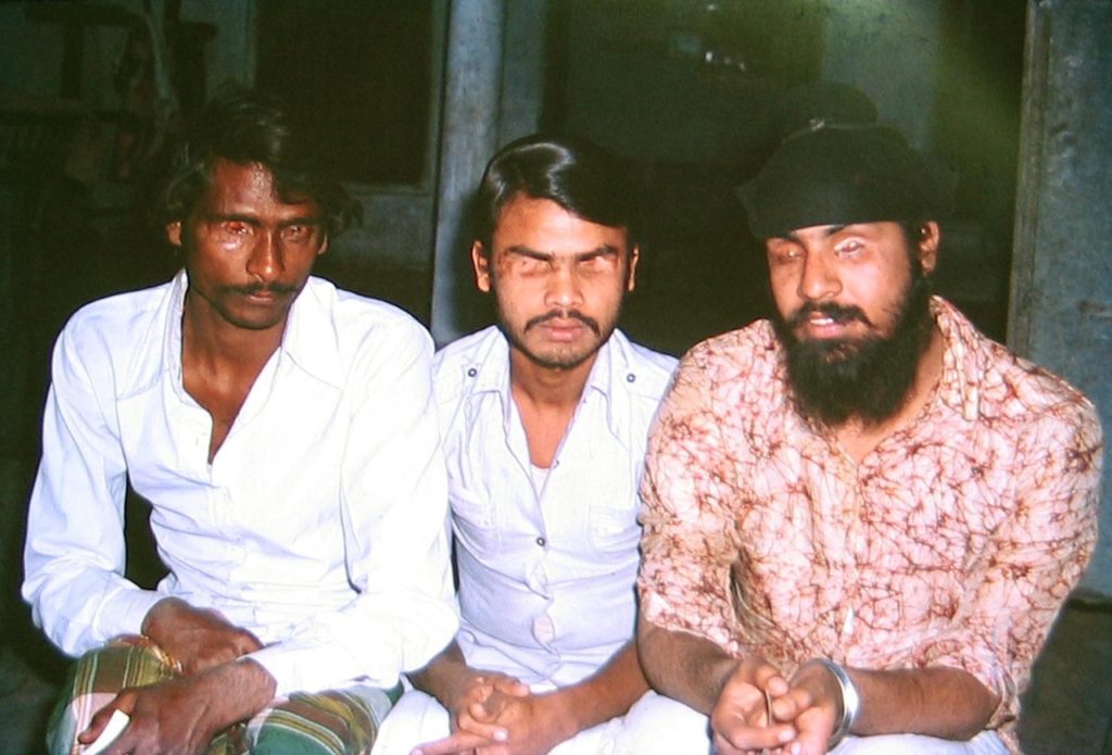 अंखफोड़बा कांड✍पीड़ितों को मुआबजा 30 हज़ार😢घटना के आधार पर बनी 'गंगाजल' फिल्म  की कमाई 16,67,31,250/- रुपये😢ये बिहार है !!! (भाग-3)